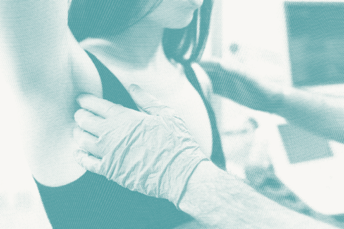 A doctor wears gloves and does a breast exam on a woman, focusing on her lymph nodes under her armpits.